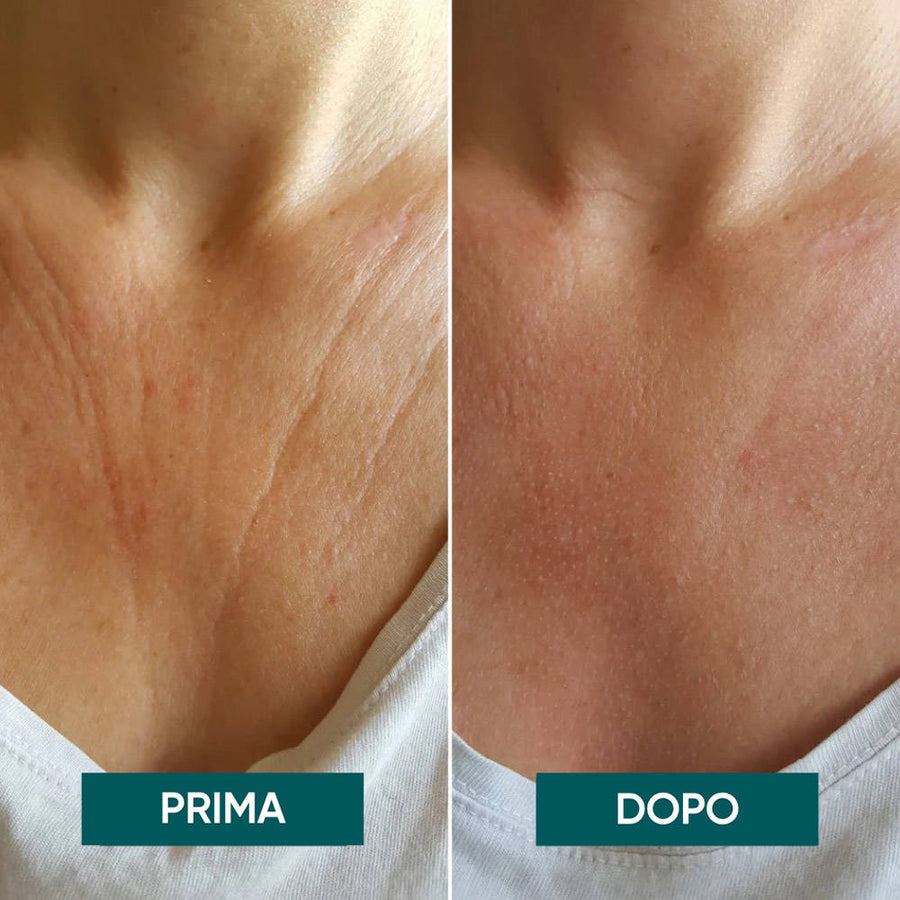 APRICOT-Patch acido ialuronico per il décolleté - riutilizzabile-AP1