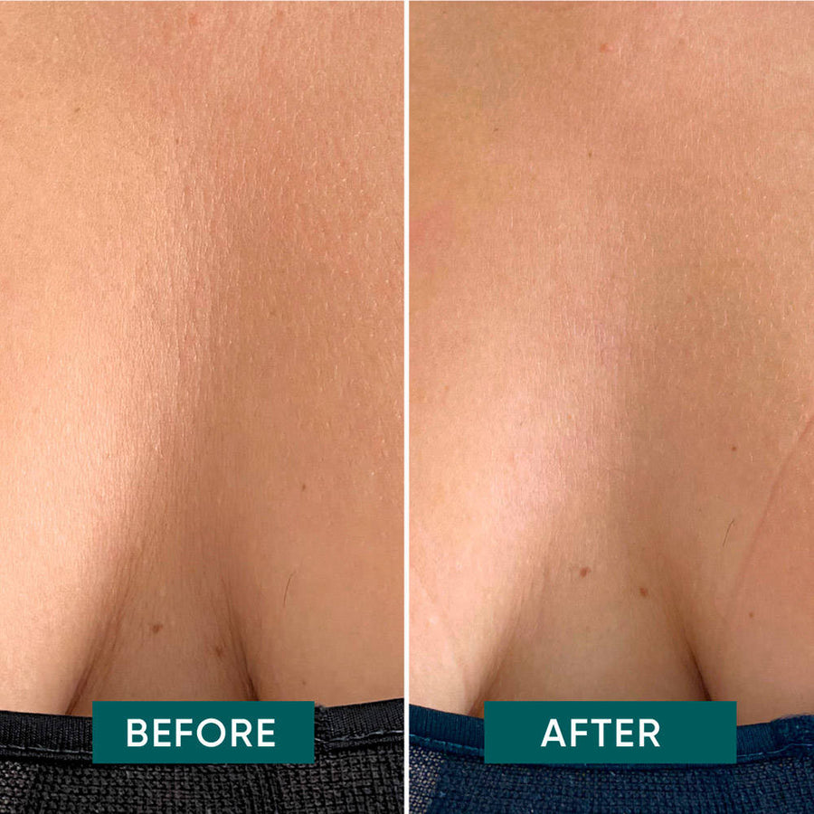 APRICOT-Patch aloe vera per il décolleté - riutilizzabile-APA03
